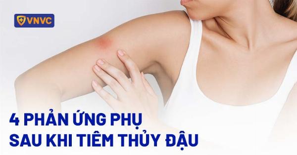 Phan tich dac diem dang mui ca si Anh Tu truoc khi xuat hien tin don sua mui